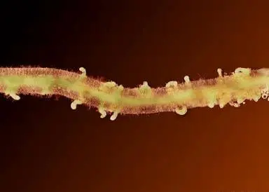 uma visão microscópica de uma raiz de planta severamente infestada por nematoides. A raiz, de coloração verde-