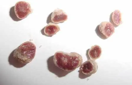 close-up de vários nódulos radiculares de uma planta leguminosa, provavelmente soja, cortados ao meio e dis